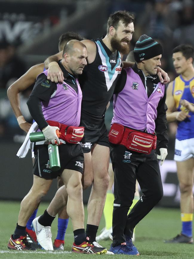 Charlie Dixon hobbles off with trainers after breaking his leg. Picture Sarah Reed