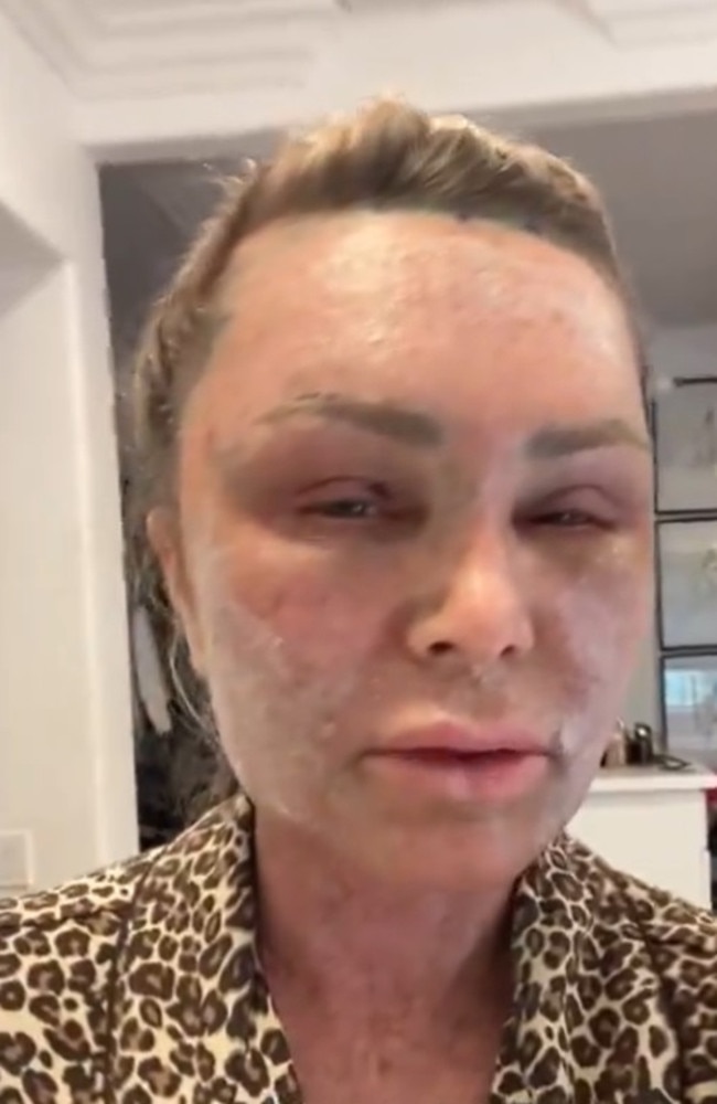 Tamra Judge shared a video of herself showing off her post-surgery recovery. Picture: TikTok.