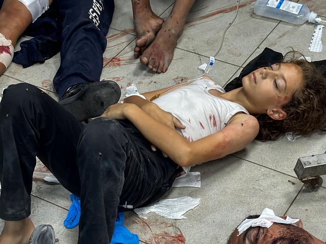 Palestinians injured in Israeli bombardment of the Beit Lahia Project area are laid on the floor awaiting treatment at the Kamal Adwan Hospital in Beit Lahia in the northern Gaza Strip. Picture: AFP