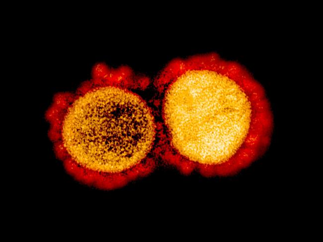 This undated handout image obtained August 11, 2020, courtesy of the National Institute of Allergy and Infectious Diseases(NIH/NIAID), shows a transmission electron micrograph of SARS-CoV-2 virus particles, isolated from a patient,captured and color-enhanced at the NIAID Integrated Research Facility (IRF) in Fort Detrick, Maryland. - Although none of the coronavirus vaccines under development has proved its efficacy yet in clinical trials, at least 5.7 billion doses have been pre-ordered around the world. First shipments of a COVID-19 vaccine created by Western laboratories have often been snapped up by the United States.Five vaccines -- three Western and two Chinese -- are in Phase 3 efficacy trials involving thousands of people.In a surprise announcement, Russian President Vladimir Putin claimed on August 11, 2020 that a vaccine dubbed "Sputnik V" -- after the Soviet satellite -- conferred "sustainable immunity" against the novel coronavirus. (Photo by Handout / National Institute of Allergy and Infectious Diseases / AFP) / RESTRICTED TO EDITORIAL USE - MANDATORY CREDIT "AFP PHOTO /NATIONAL INSTITUTE OF ALLERGY AND INFECTIOUS DISEASES/HANDOUT " - NO MARKETING - NO ADVERTISING CAMPAIGNS - DISTRIBUTED AS A SERVICE TO CLIENTS