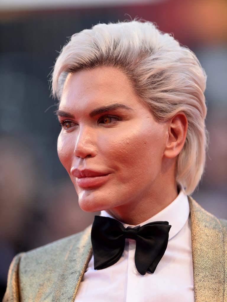 Former Human Ken Doll Unrecognisable In Photos After Extreme Plastic
