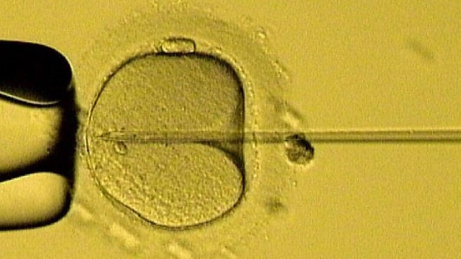 Male sperm is injected into a female egg. Sexual reproduction has a profound effect on who we are as a species – and it is those of us who produce eggs that carry the heaviest burden because of it.