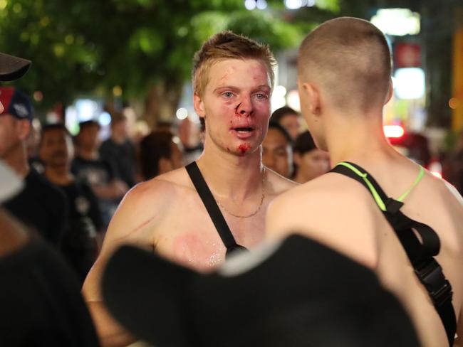 Perhaps this young man should have stayed home. Picture: Liam Kidston