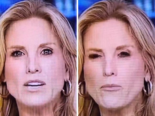 Vanessa Welch swallowed a fly.