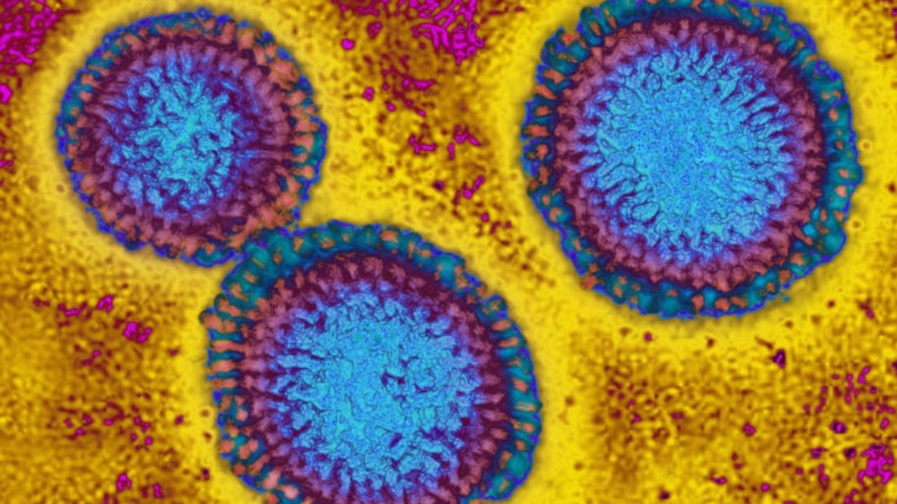 Aussies warned of triple virus surge threat