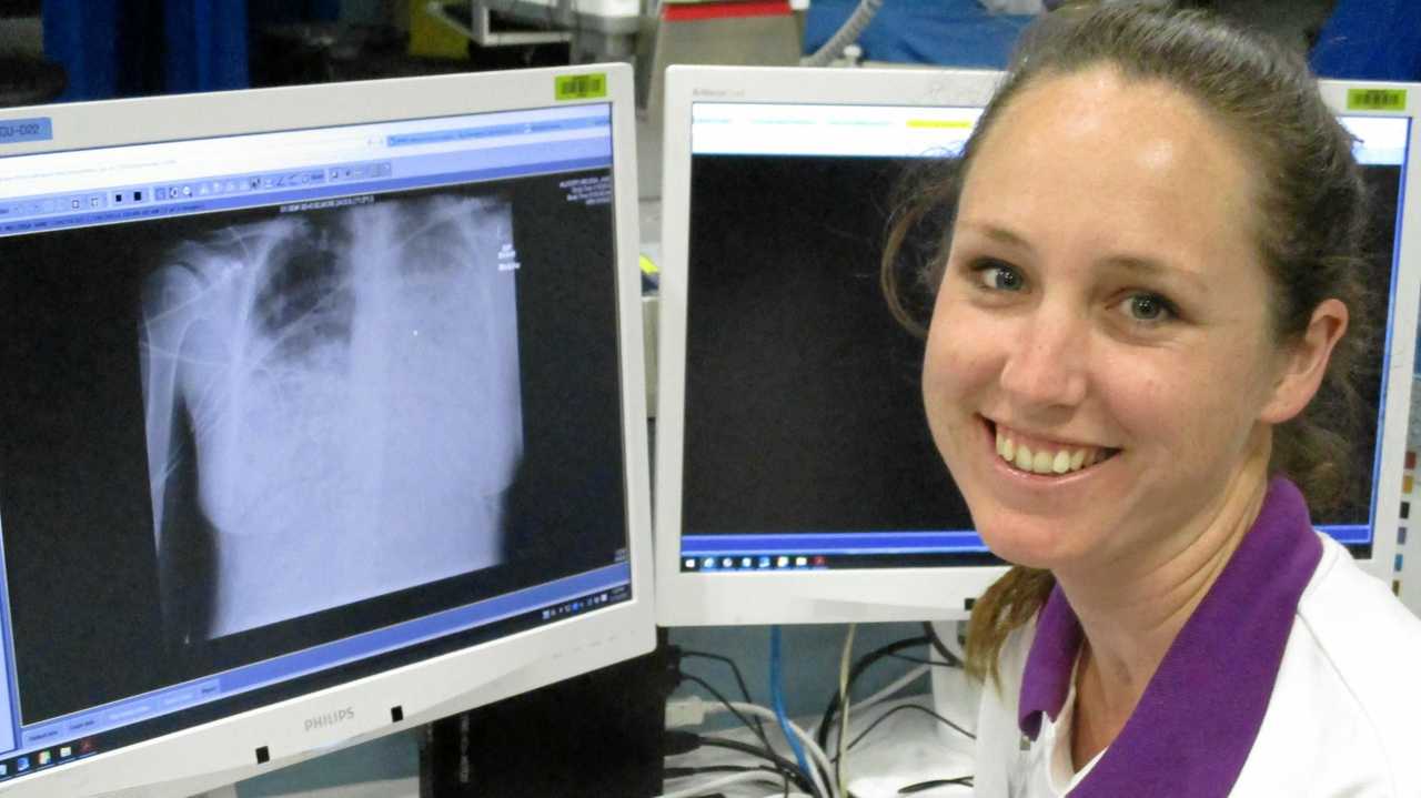 LOOKING BACK: Nurse Melissa Allsopp looks at her chest x-ray from four years ago showing a severe pneumonia infection.