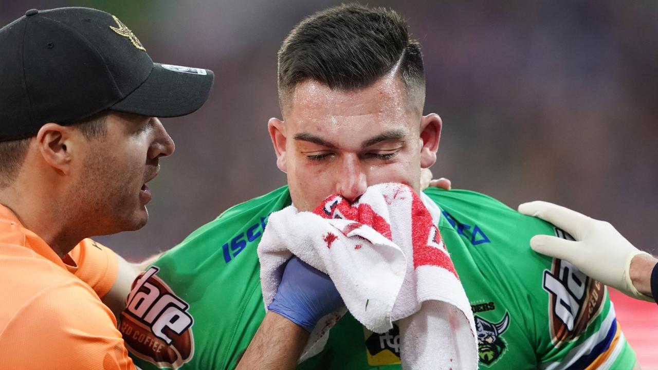 Nick Cotric broke his nose and did not return from a HIA against the Storm.