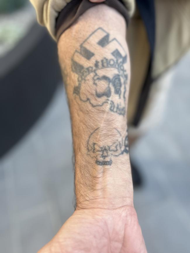 Andrew Kirby showing the last of his racist tattoos, a swastika he is saving to have covered up.