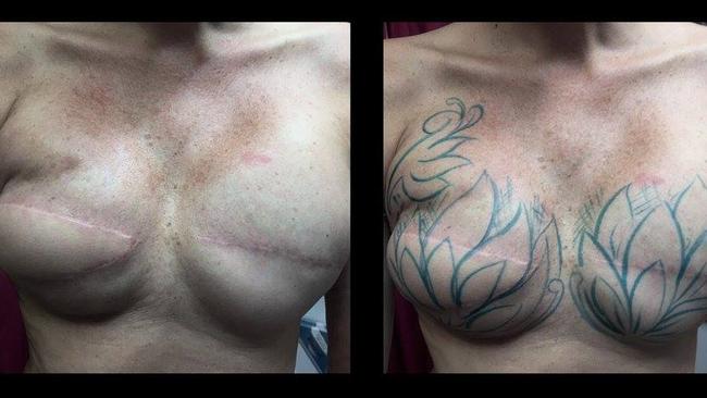 Before the Darwin tattoo artist covered up the double mastectomy