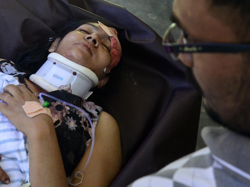 An injured Sri Lankan woman lays on a stretcher at a hospital following an explosion at a church in Batticaloa in eastern Sri Lanka on April 21, 2019. Picture: AFP