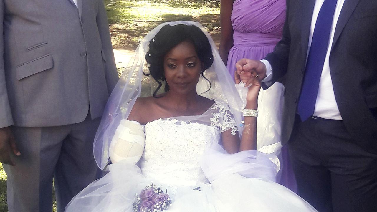 Crocodile Attack: Couple Marries In Zimbabwe Just Days After Attack 