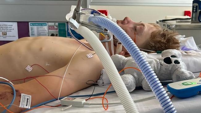 14-year-old Jack Evans-Wood’s accident led to five spinal vertebrae being fractured, biting so hard that he almost detached his tongue and needing to be placed in an induced coma, he spent six days in the Intensive Care Unit.