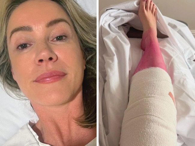 Leila McKinnon shared "alarming" pictures from her hospital bed. Picture: Instagram