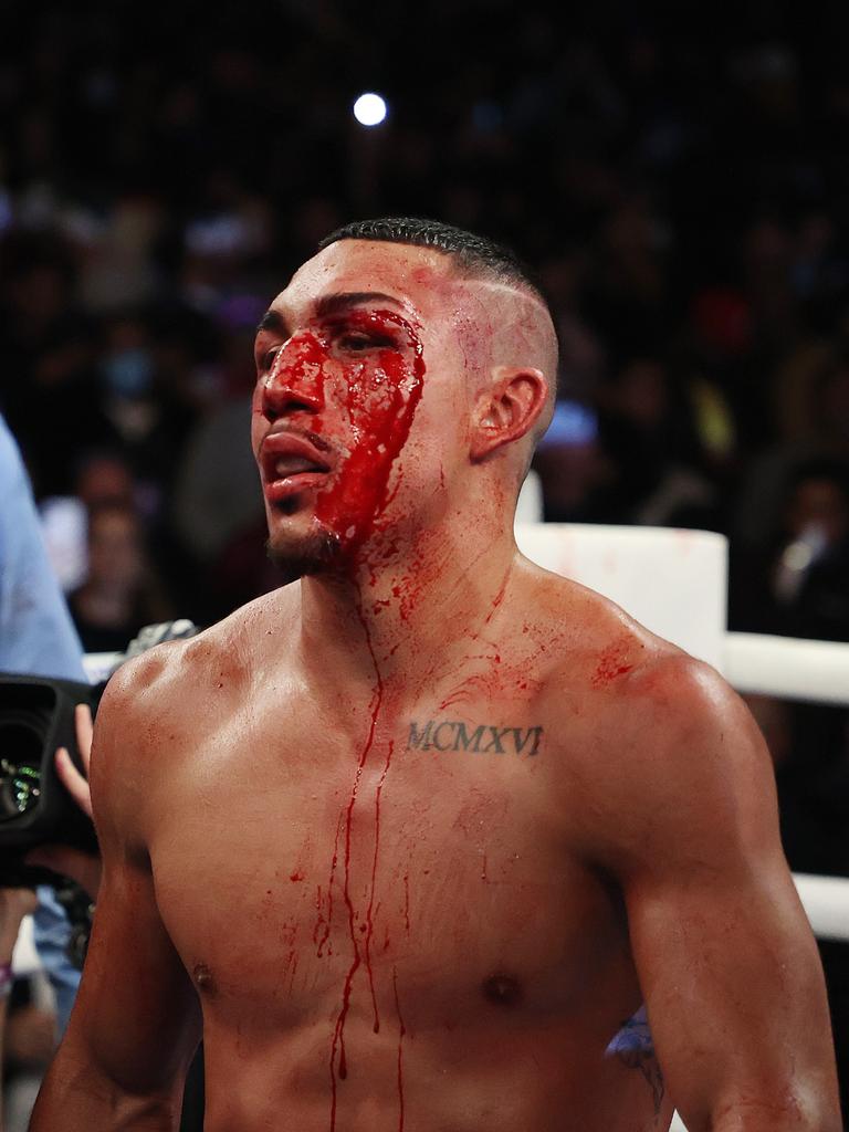 Teofimo Lopez dominating the fight. Photo: Al Bello/Getty Images/AFP.
