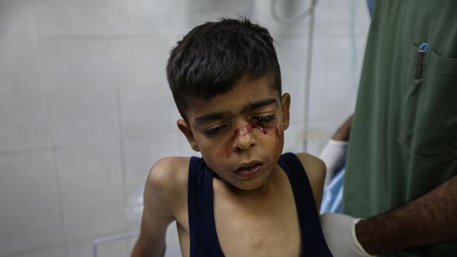 A boy severely injured by Israeli air strikes. Picture: Ahmad Hasaballah