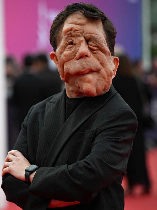 British actor Adam Pearson. Picture: AFP