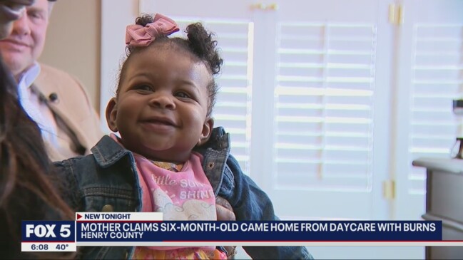 Baby Girl ‘attacked’ By One-year-old At Angel’s Haven Daycare | The ...