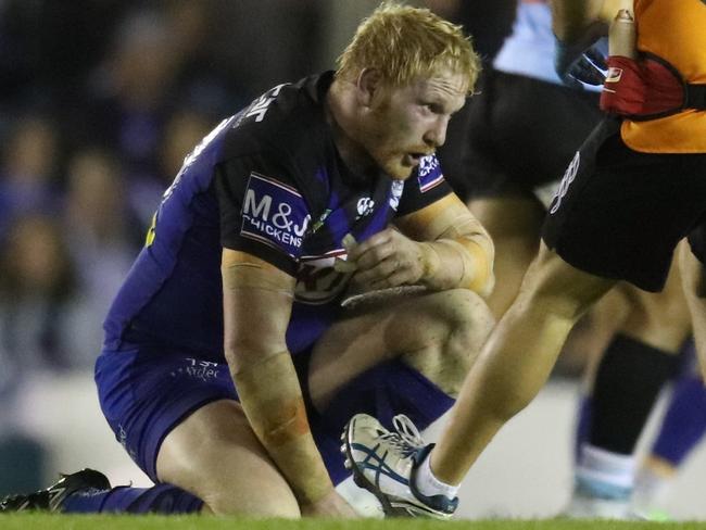 James Graham of the Bulldogs is injured during the Round 12 NRL match between the Cronulla-Sutherland Sharks and the Canterbury-Bankstown Bulldogs at Southern Cross Group Stadium in Sydney, Saturday, May 27, 2017. (AAP Image/Craig Golding) NO ARCHIVING, EDITORIAL USE ONLY