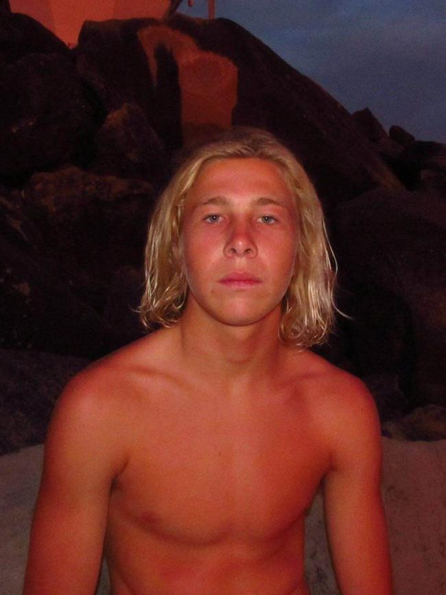 Surfer Cooper Allen was mauled by a shark yesterday morning. Picture: Supplied