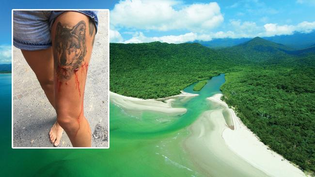 24-year-old tourist bitten by a small crocodile at Cape Tribulation. Source: Facebook