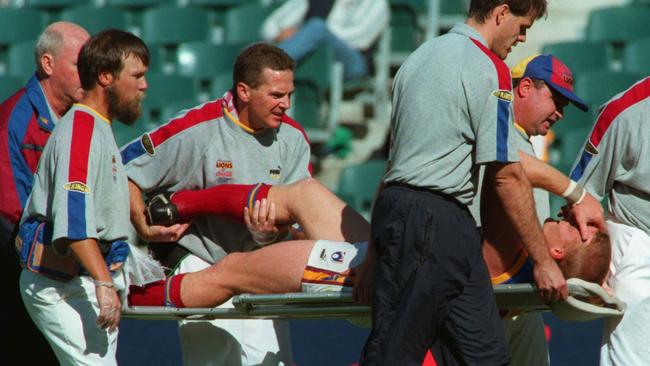 Michael Voss after breaking his leg in 1998.