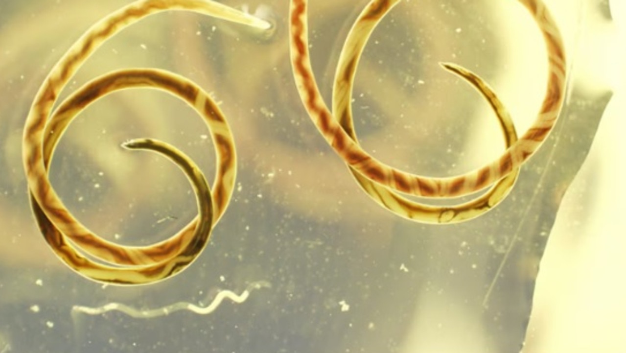 Rat lungworm parasite. Picture: Centres for Disease Control and Prevention