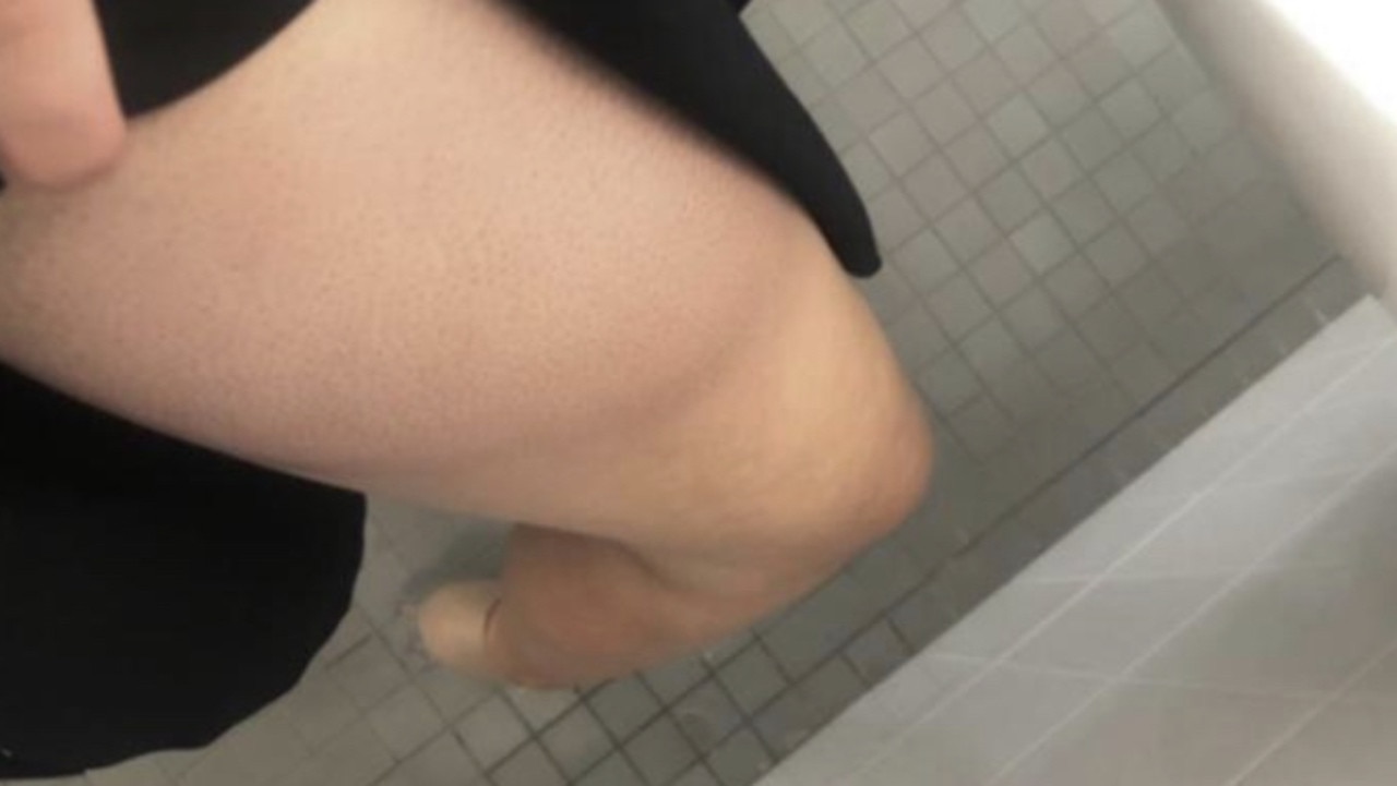 Brittany Higgins took this photograph of her bruised leg while in the Parliament House bathroom.