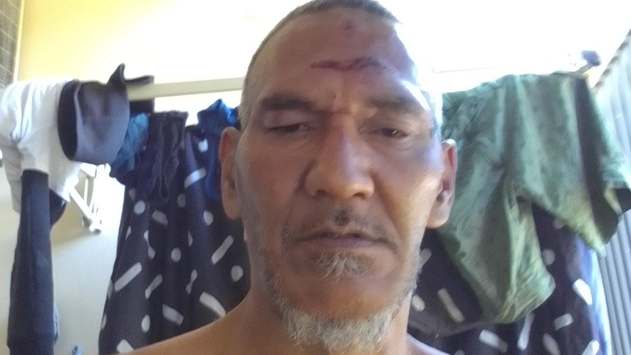 ‘Prone and defenceless’: ‘Vicious’ head stomping assault on father