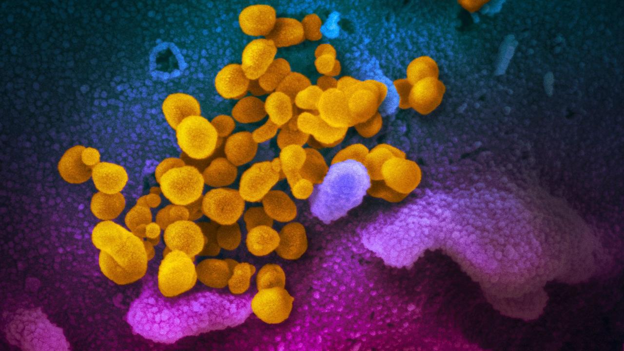 A new strain of the Delta virus has been discovered in NSW. Picture: National Institutes of Health/AFP