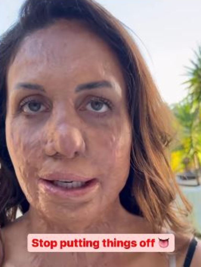 Turia Pitt has opened up about a shock health scare. Picture: Instagram