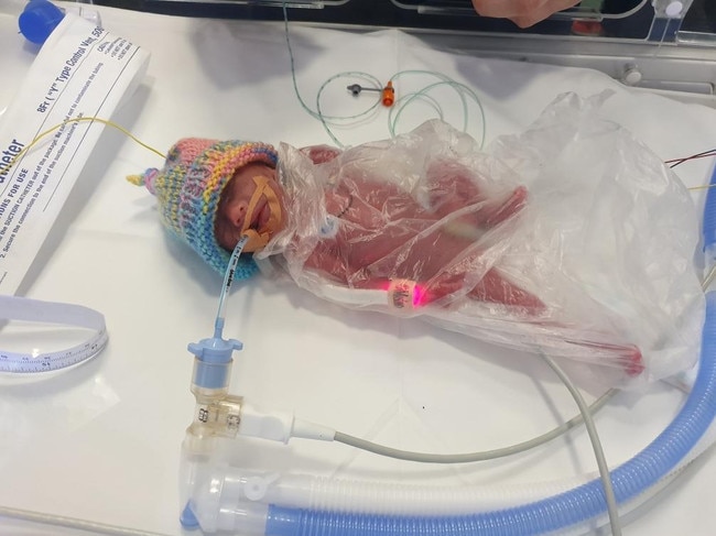 Skylah Austin was born at 24 weeks in February and at just 475 grams, she is one of the smallest babies to survive.