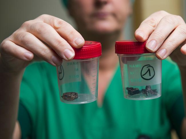 A nurse of the 'Campus Gasthuisberg UZ' hospital in Leuven, outside Brussels, shows fragments of iron shrapnel from a nail bomb, found in victim's bodies, two days after a triple bomb attack.