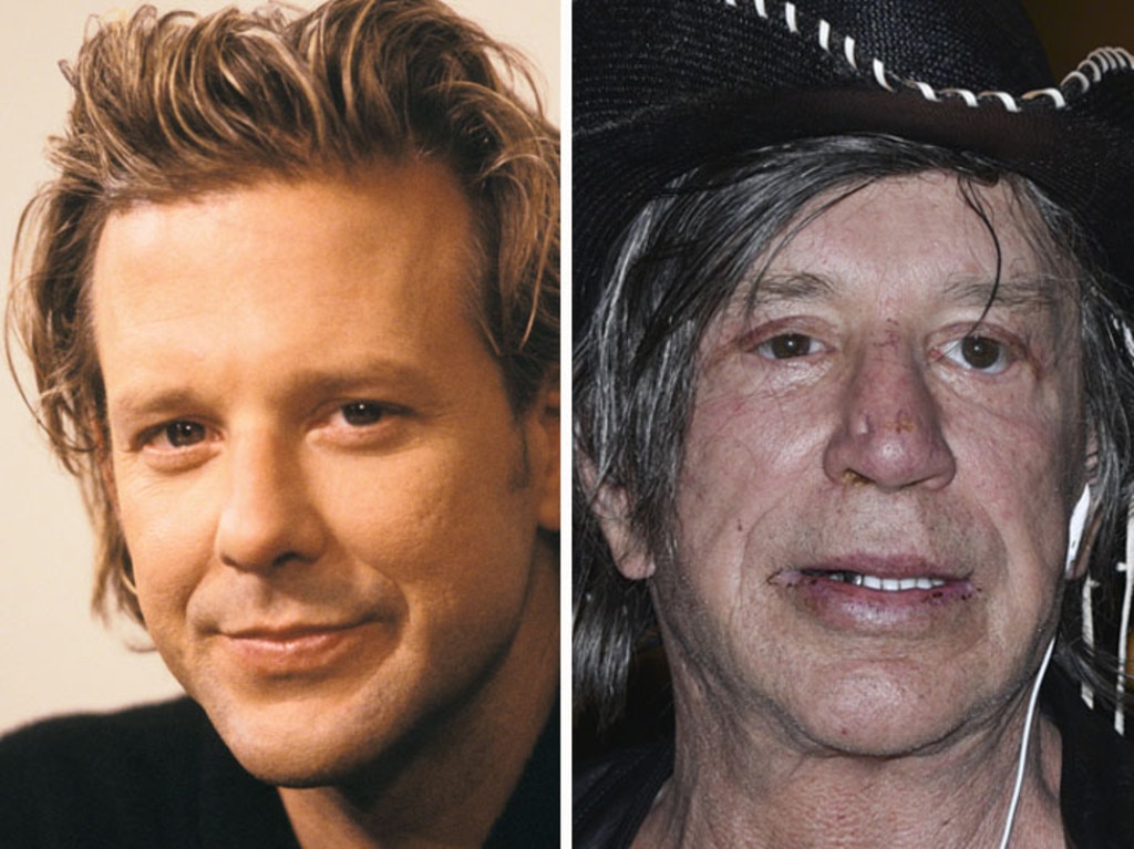 Mickey Rourke on his surgery: ‘Most of it was to mend the mess of my face after boxing. I went to the wrong guy to put my face back together,’ he told the Daily Mail in 2009. Picture: Getty Images