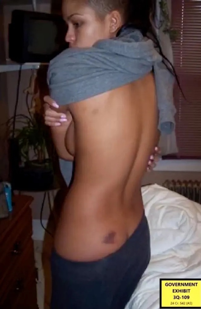 Cassie Ventura shows a bruise she alleges was inflicted by Diddy. Picture: Department of Justice