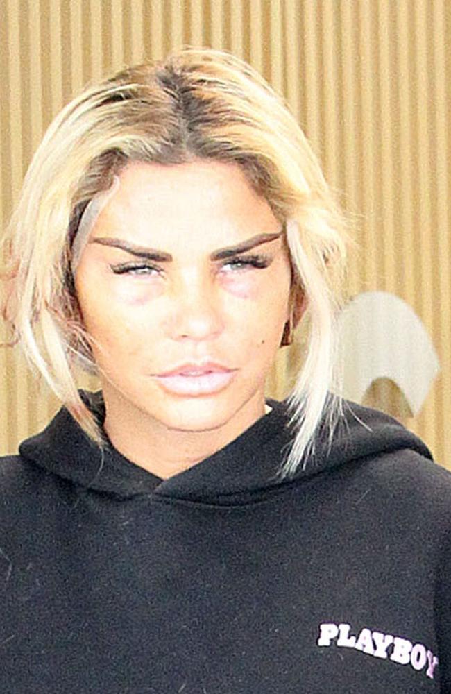 Katie Price leaves a surgeon’s office in Turkey. Picture: Backgrid