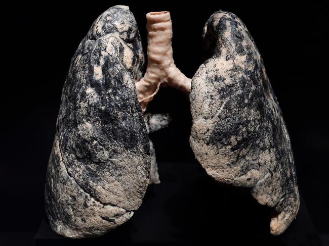 Ex-miner sues major coal company over black lung diagnosis