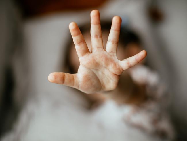 iStock child abuse generic images