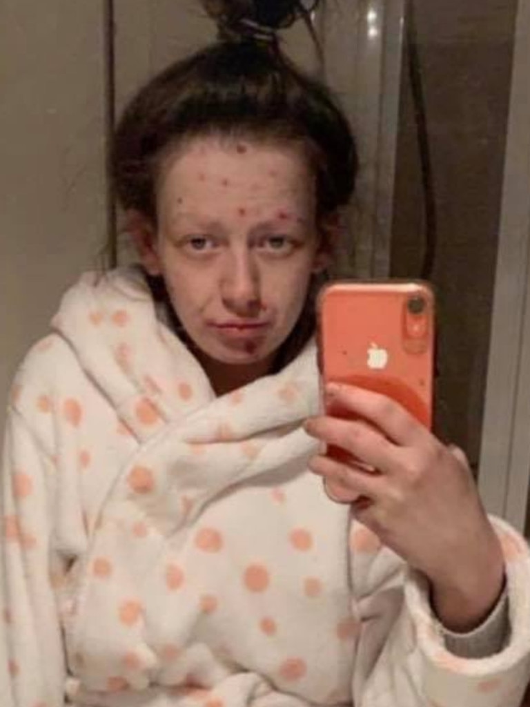 The mother-of-two said her journey to recovery hasn’t been a ‘walk in the park’. Picture: Facebook/Demi-Nicole Dunlop