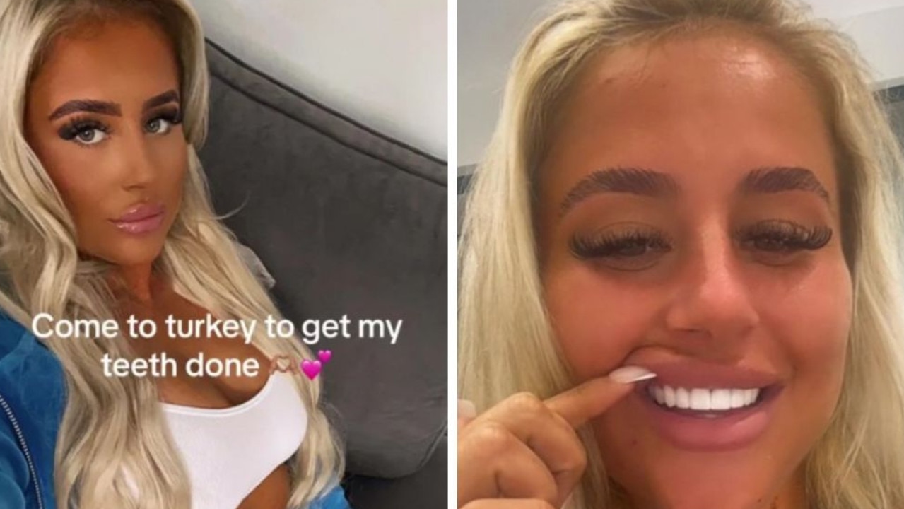 Woman trolled for ‘horse teeth’ after surgery