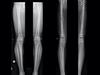 Why men undergo ‘sick’ procedure