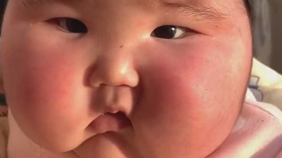 The baby girl ballooned in size and grew hair on her face after her parents began using the steroid cream Yifulin on her. Picture: @youzibaobao/Newsflash