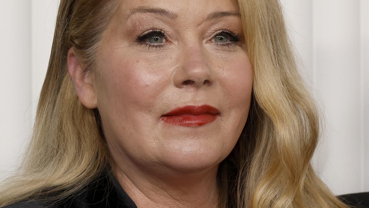 Christina Applegate Says She Has 30 Lesions On Her Brain Amid MS Battle ...