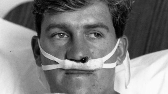 South Adelaide footballer Brenton Honor recovering in hospital in 1989 after surgery for persistent headaches suffered in an on-field clash with Port's Andrew Obst.