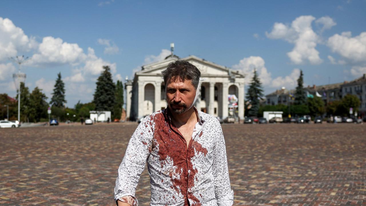 An injured man walks off the site of a missile strike, near the Taras Shevchenko Chernihiv Regional Academic Music and Drama Theatre, in Chernihiv. Picture: Anatolii Stepanov/AFP