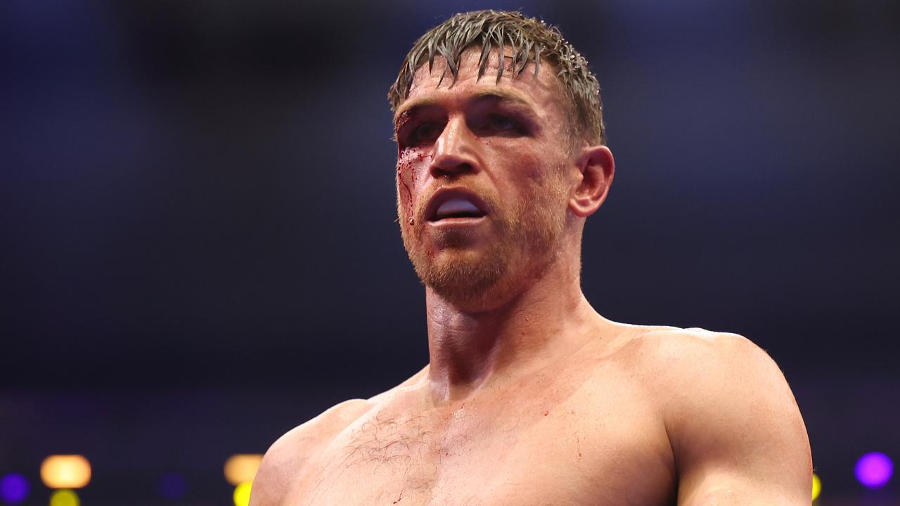 Callum Smith with a cut to his right eye. Photo by Richard Pelham/Getty Images.