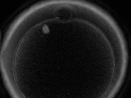 A mature egg with abnormal spindle. Picture: IVF Australia