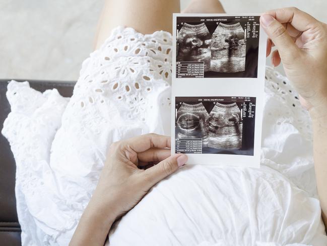 Close up of pregnant woman holding ultrasound scan