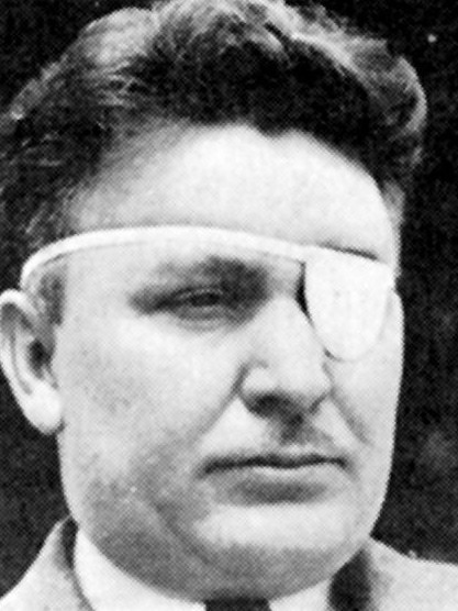 Wiley Post lost his eye after an industrial accident.