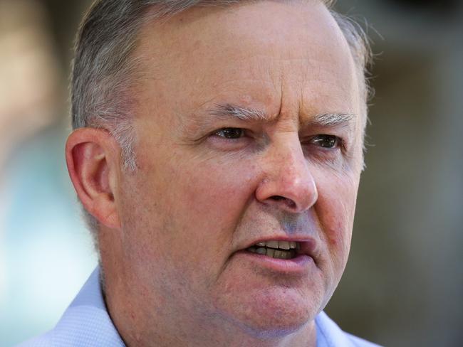 SYDNEY, AUSTRALIA - JANUARY 09, 2021: Anthony Albanese Leader of the Opposition and Leader of the Labor Party is seen leaving the RPA Hospital today after a car accident yesterday in Marrickville in Sydney, Australia. Picture: Newscorp - Sunday Telegraph / Gaye Gerard