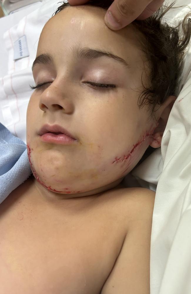 Dante, 6, in hospital after he was viciously mauled by a neighbour's dog at a Rockhampton home on January 5, 2024.